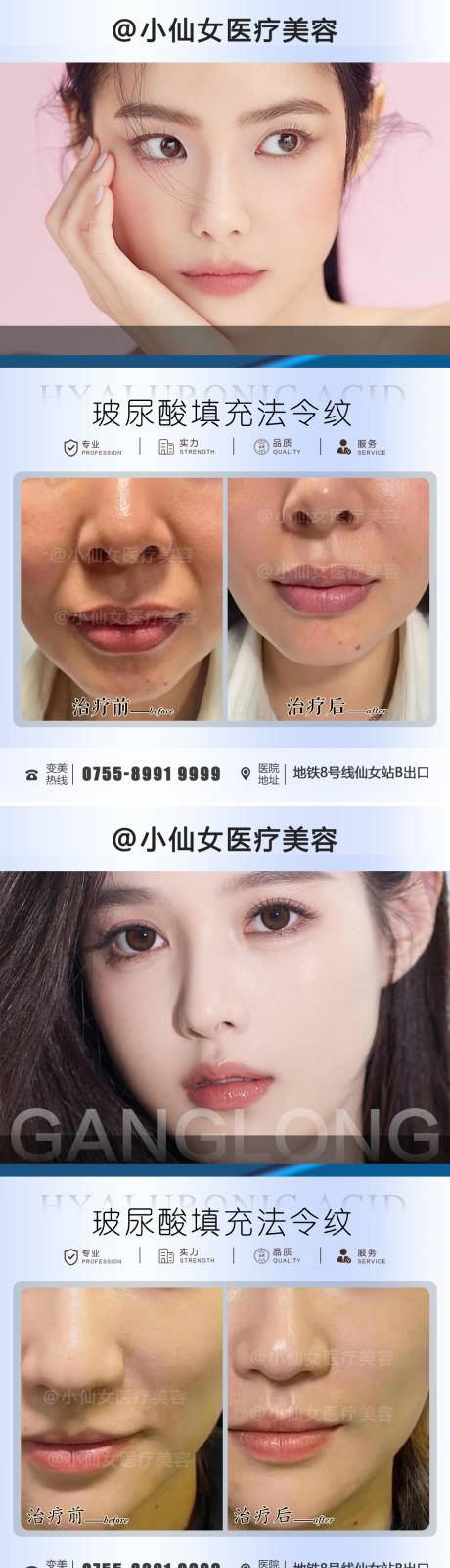 源文件下載【享設計】搜索編號：81860011656583613【玻尿酸填充案例海報】