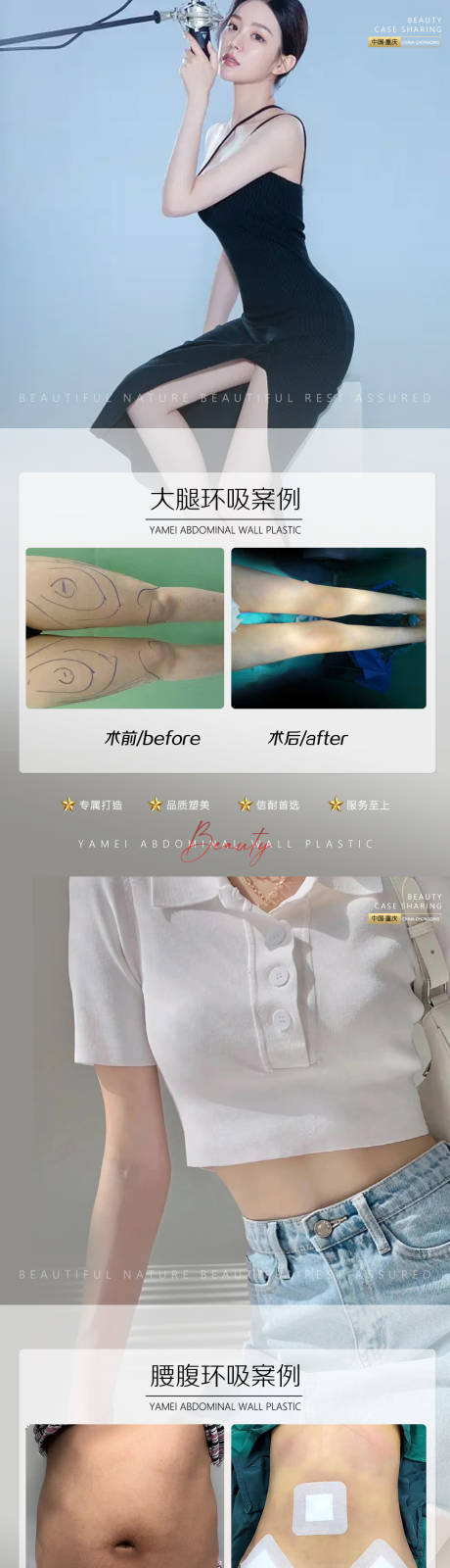 源文件下载【享设计】搜索编号：79110011798127438【案例大腿环吸腰腹环吸0823】