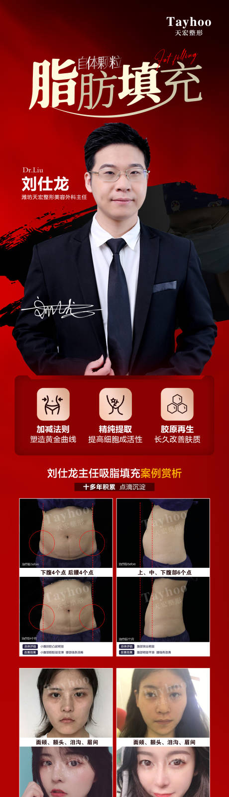 源文件下载【医美整形品牌脂肪填充医生专家案例】编号：77470011945178576