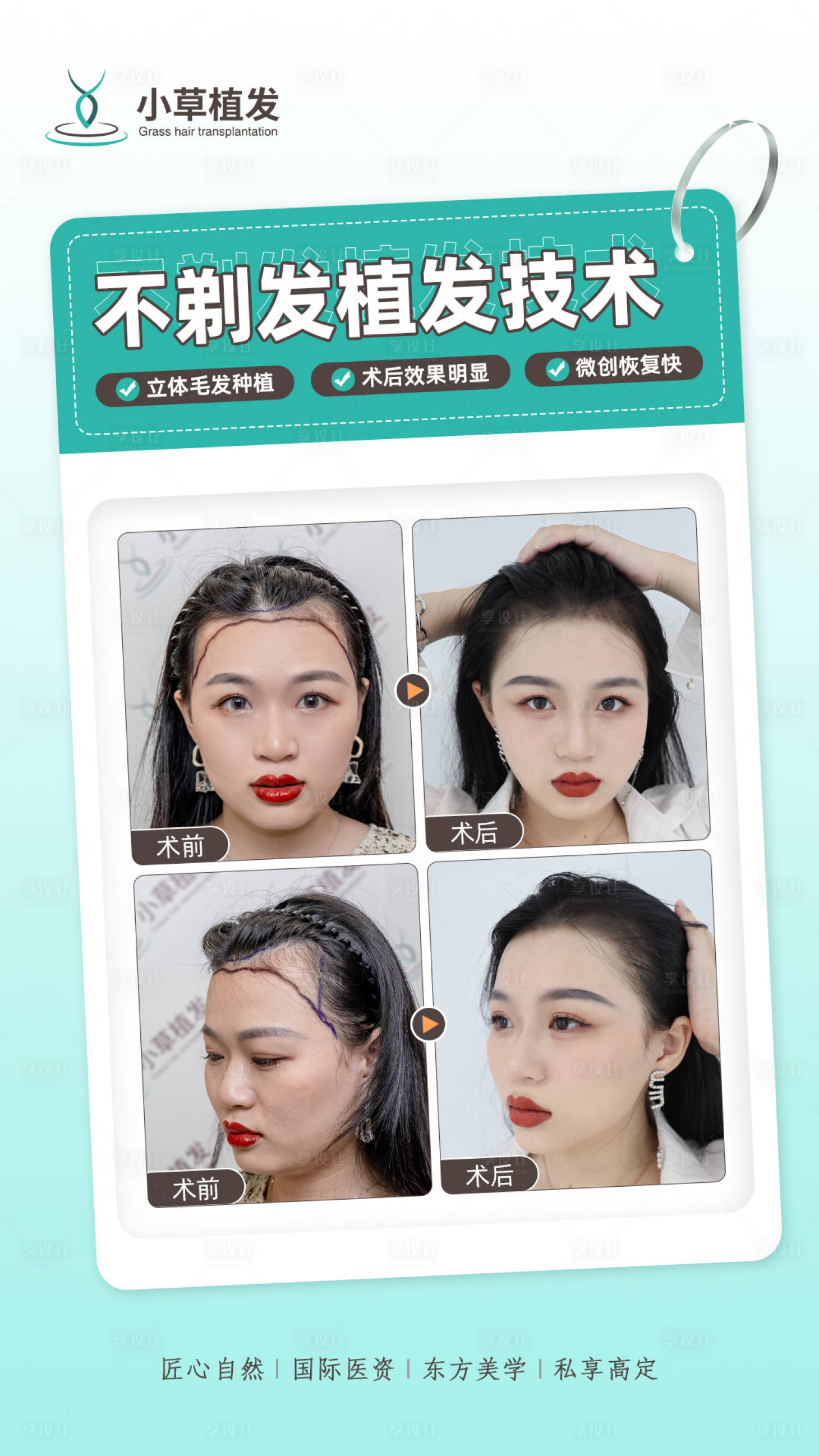 源文件下载【医美案例对比模板海报】编号：46660011575579756