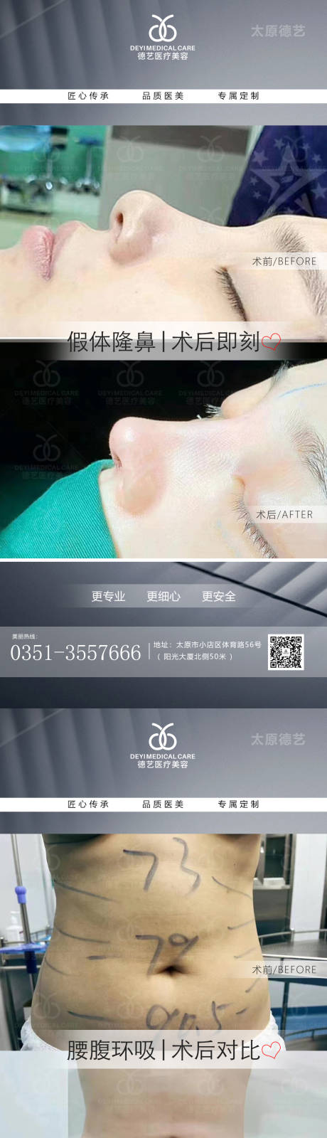 源文件下載【享設(shè)計】搜索編號：62410011504725633【醫(yī)美案例對比圖海報 】