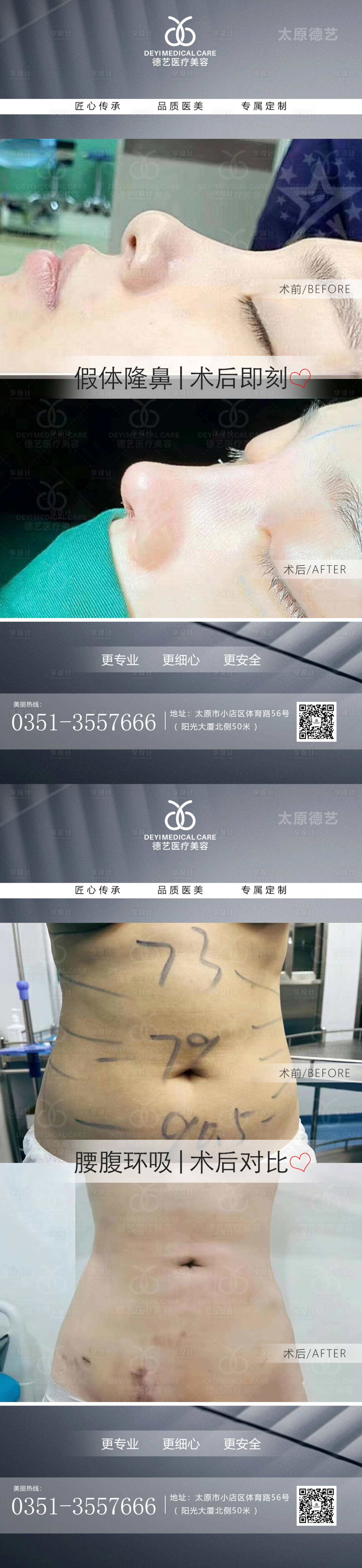 源文件下载【享设计】搜索编号：62410011504725633【医美案例对比图海报 】