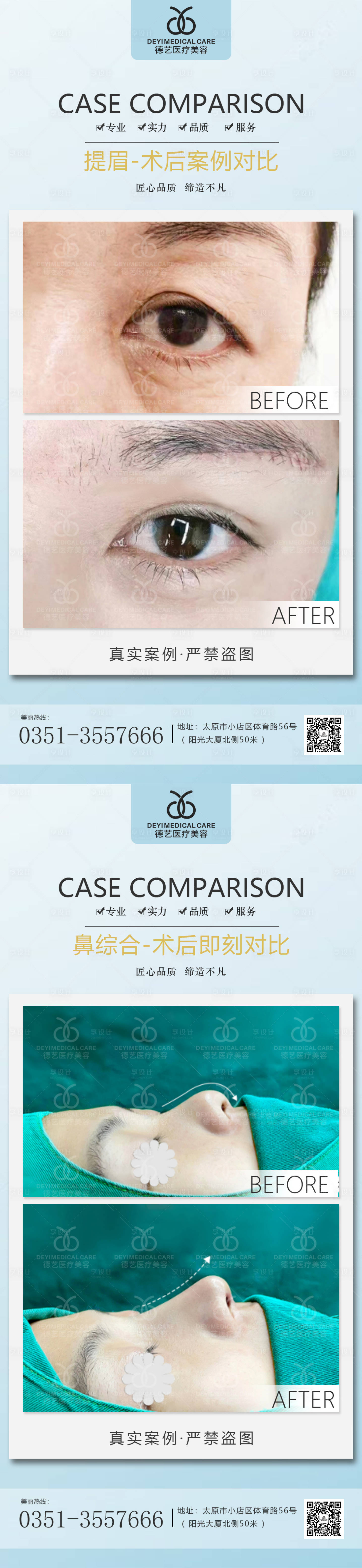 源文件下載【享設計】搜索編號：35210011502304976【醫美案例對比圖】