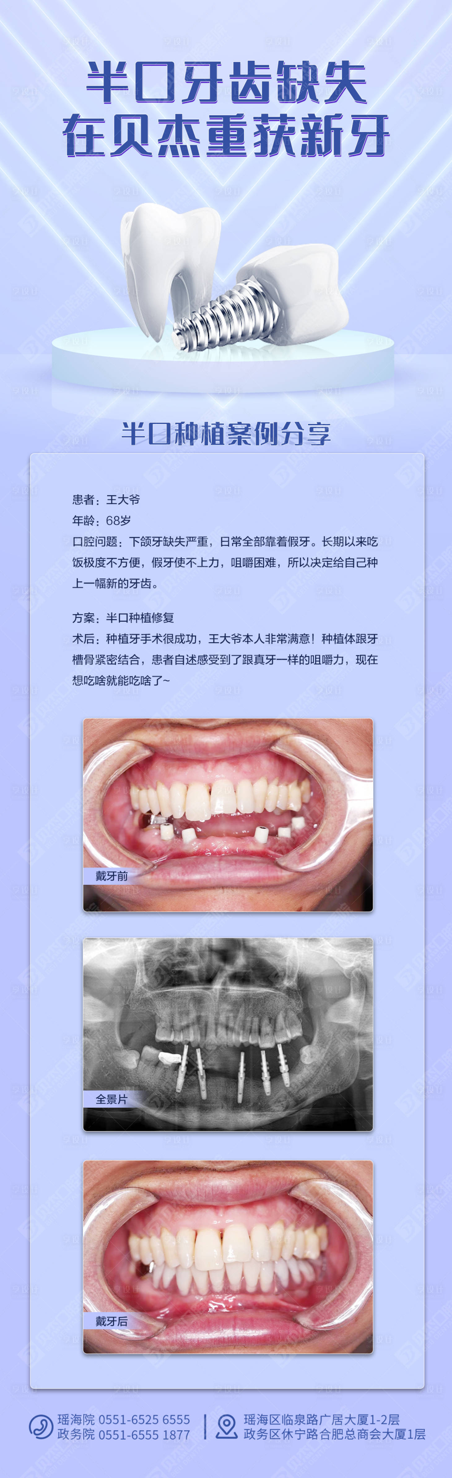 源文件下載【享設計】搜索編號：60240011857696530【半口缺失案例】