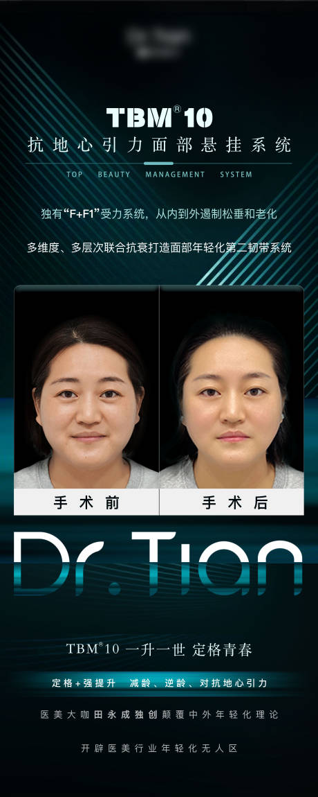 源文件下载【医美案例易拉宝】编号：34650011485169118
