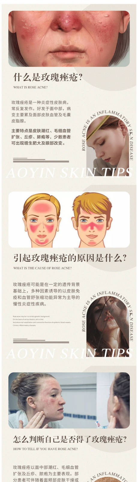 源文件下载【享设计】搜索编号：61910011657261744【玫瑰痤疮常识干货分享】