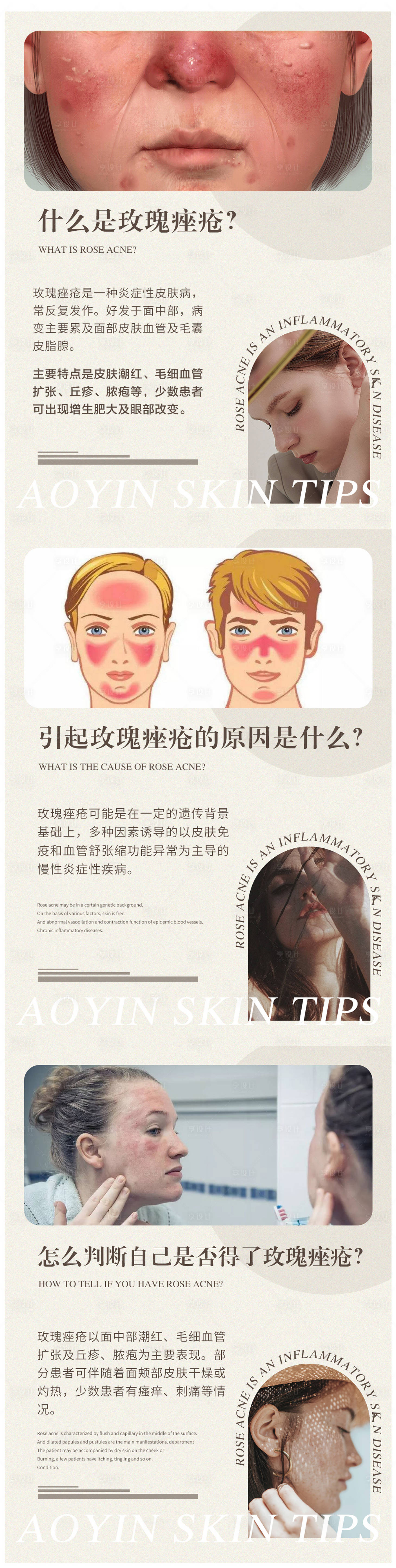 源文件下载【享设计】搜索编号：61910011657261744【玫瑰痤疮常识干货分享】