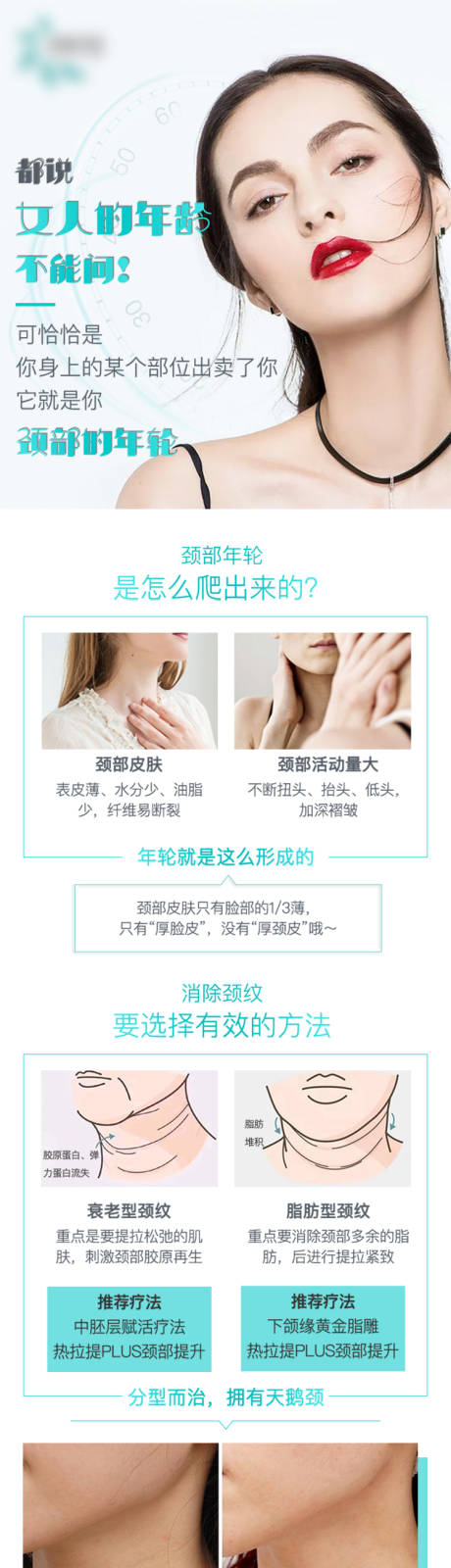 源文件下载【享设计】搜索编号：93780011864579806【天鹅颈祛颈纹简约海报】