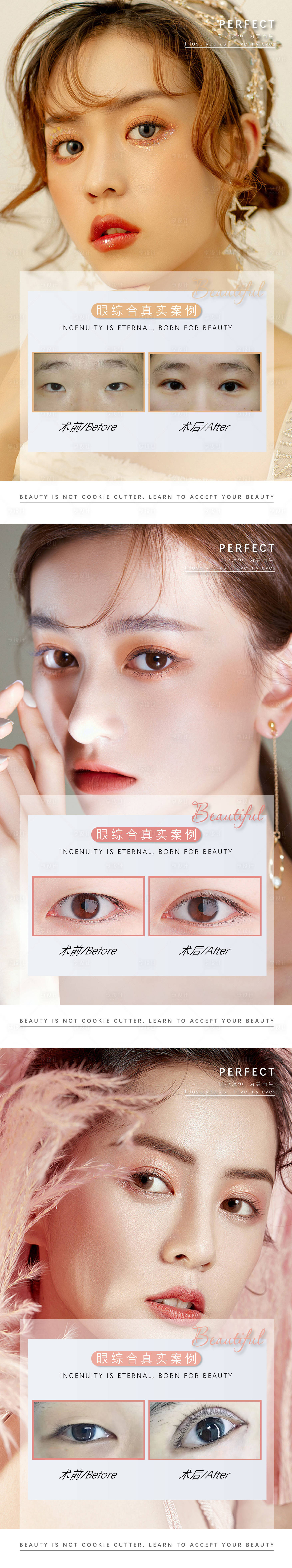 源文件下載【享設計】搜索編號：97750011676716457【醫美眼綜合案例系列海報】