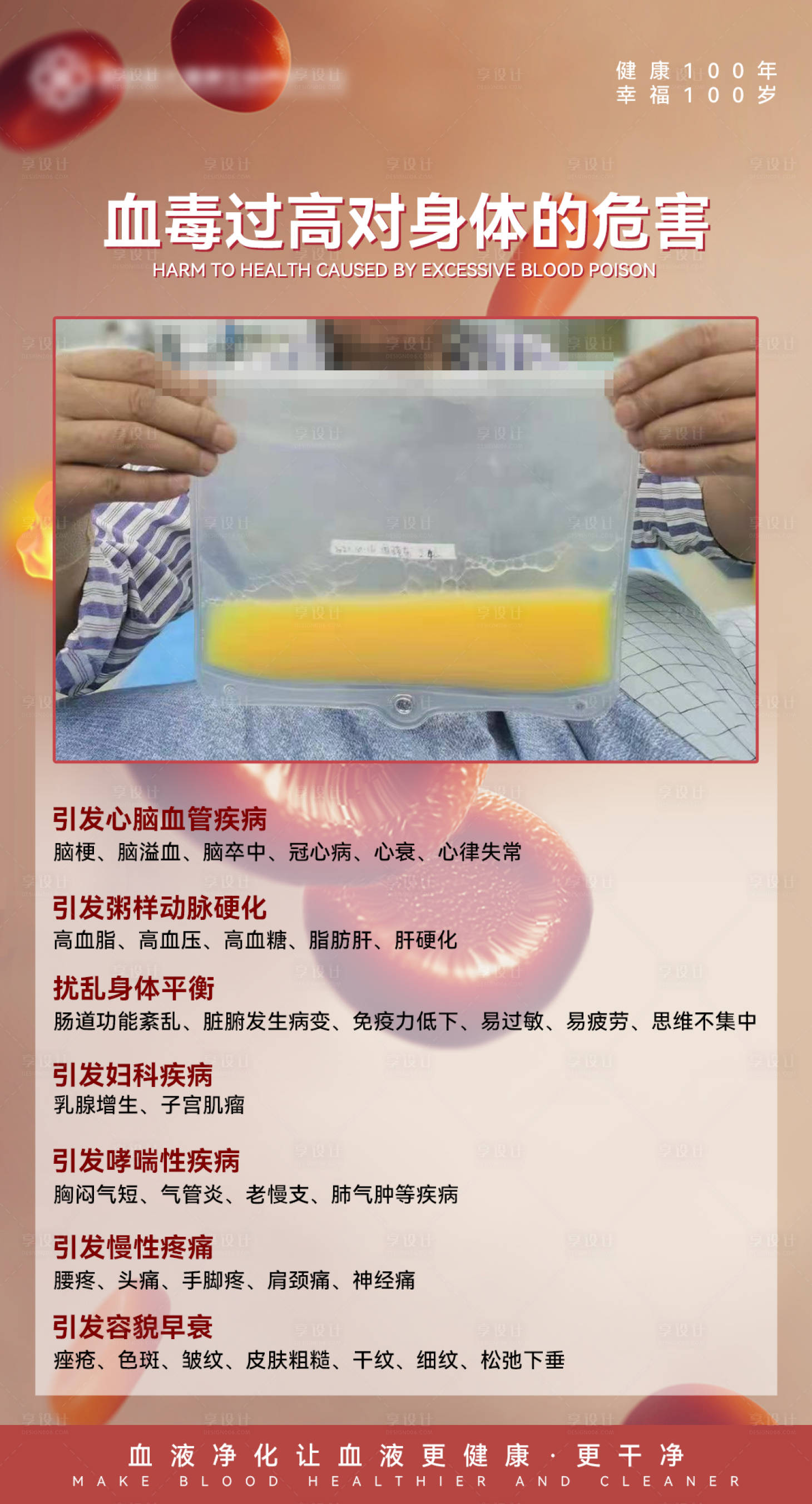 源文件下载【享设计】搜索编号：56550011500045884【血液净化】