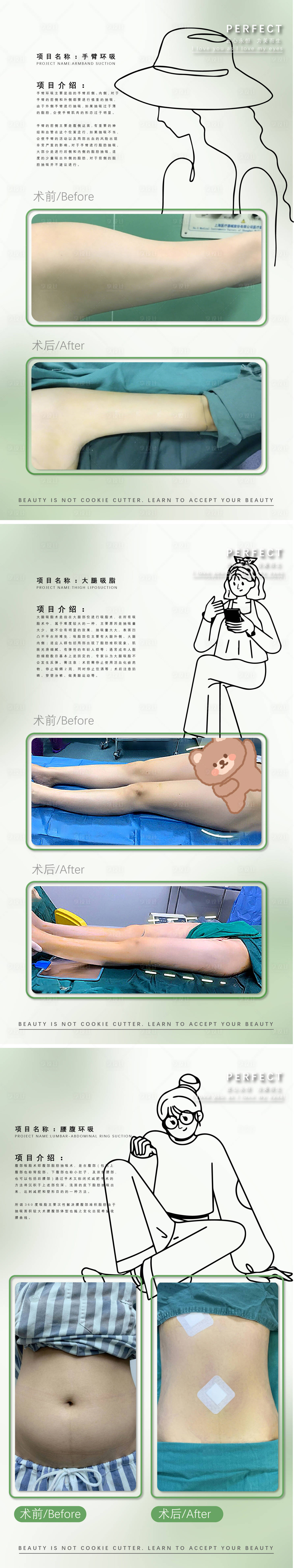 源文件下載【享設計】搜索編號：56150011691684030【醫美吸脂案例】