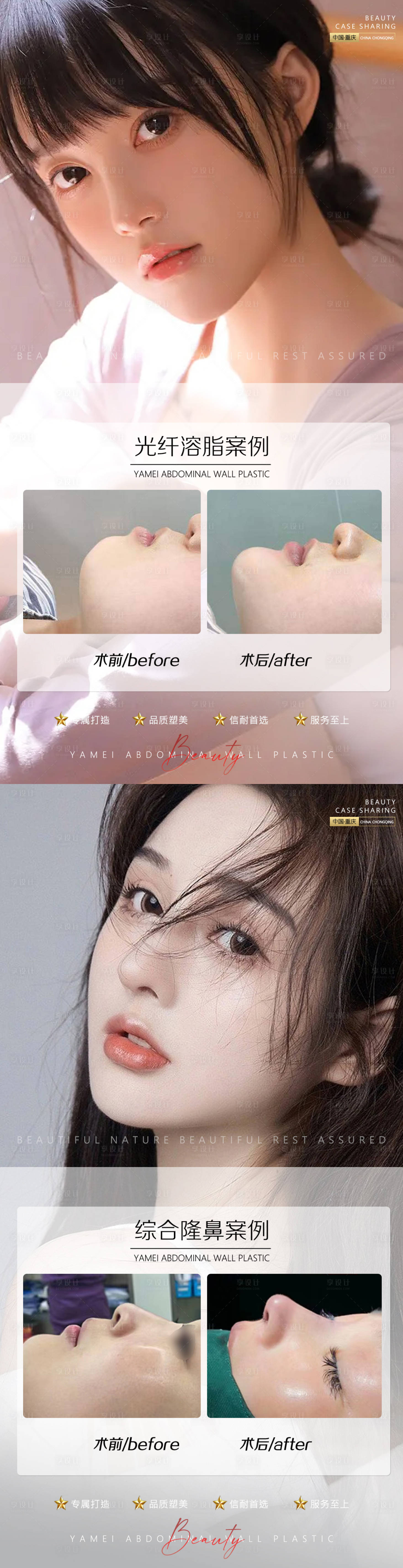 源文件下载【案例光纤溶脂鼻子案例】编号：98230011779485641