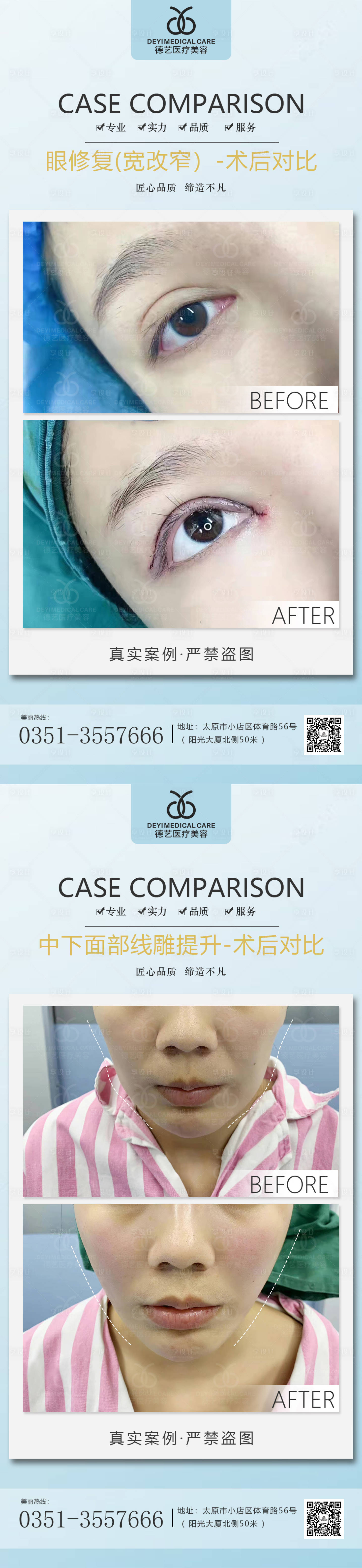 源文件下載【享設(shè)計】搜索編號：85570011503504713【醫(yī)美案例對比系列海報】