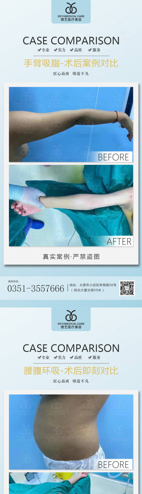 源文件下载【医美案例对比图】编号：83180011503273370