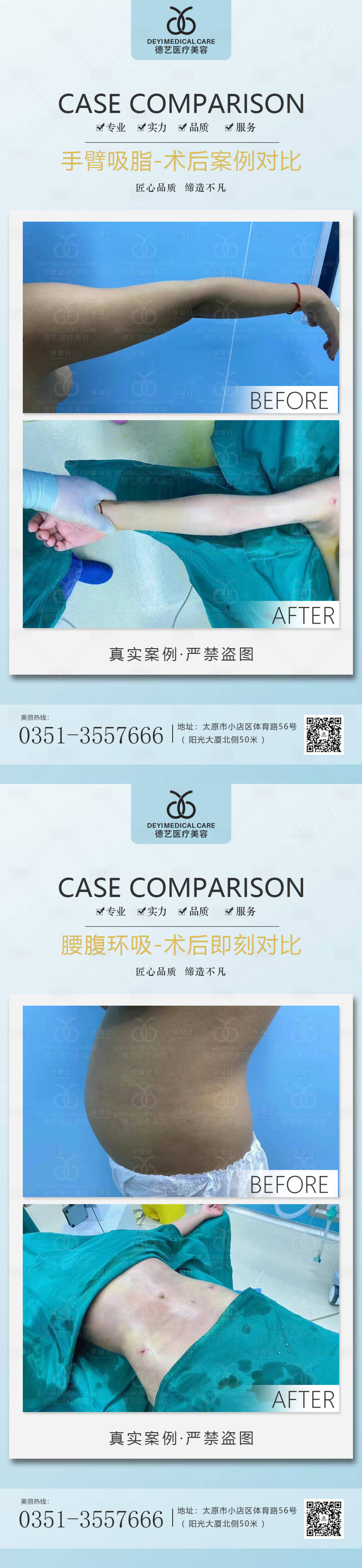 源文件下载【医美案例对比图】编号：83180011503273370
