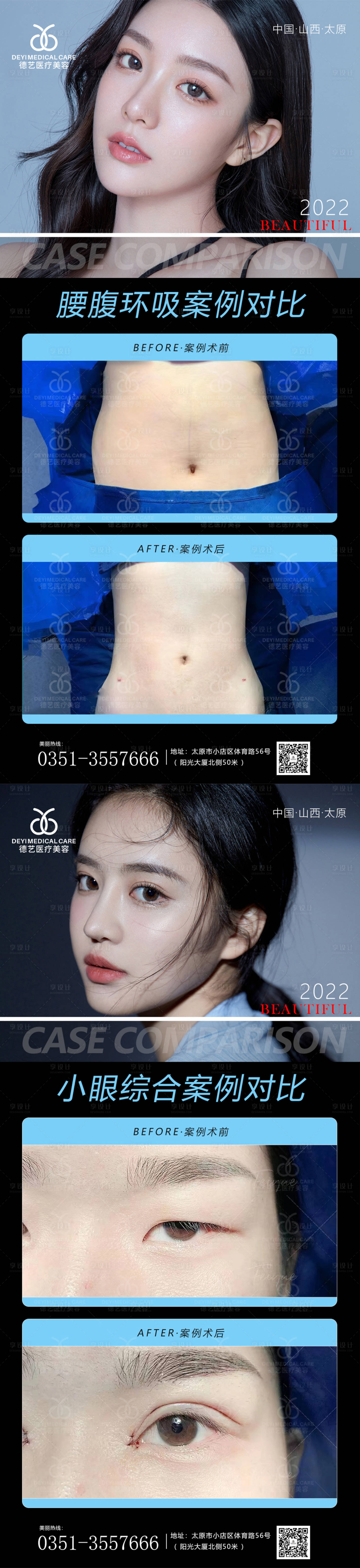 源文件下载【享设计】搜索编号：75630011403614614【医美案例对比图】