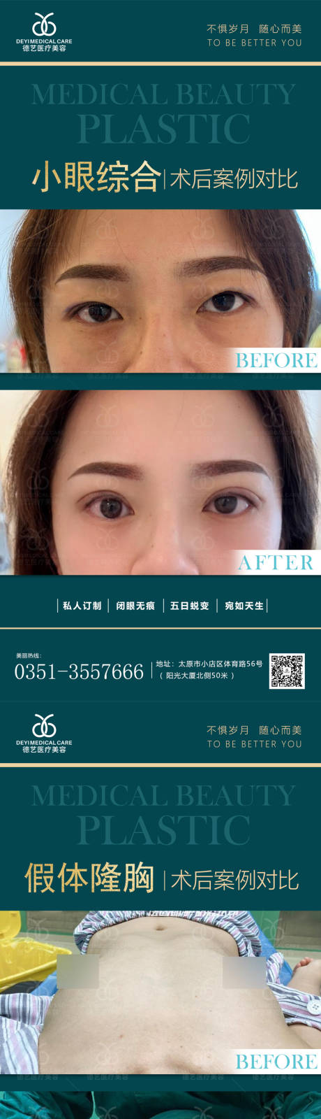 源文件下载【医美案例对比图】编号：40360011436157217