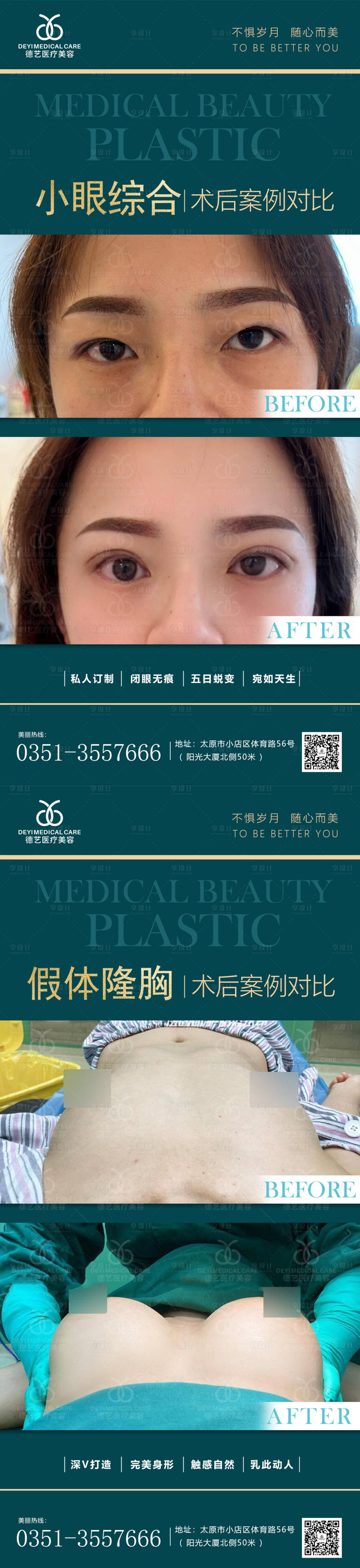 源文件下载【享设计】搜索编号：40360011436157217【医美案例对比图】