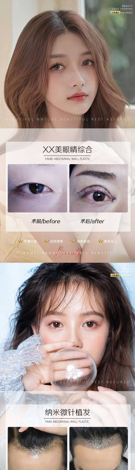 源文件下載【享設(shè)計】搜索編號：72260011692919401【醫(yī)美案例眼睛和植發(fā)海報】