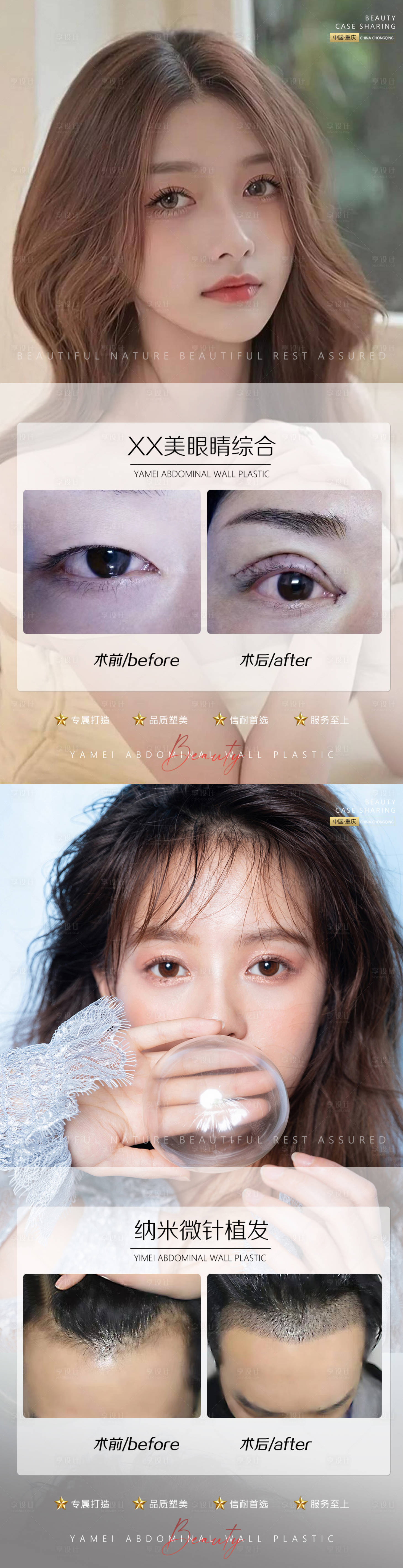 源文件下載【享設計】搜索編號：72260011692919401【醫美案例眼睛和植發海報】
