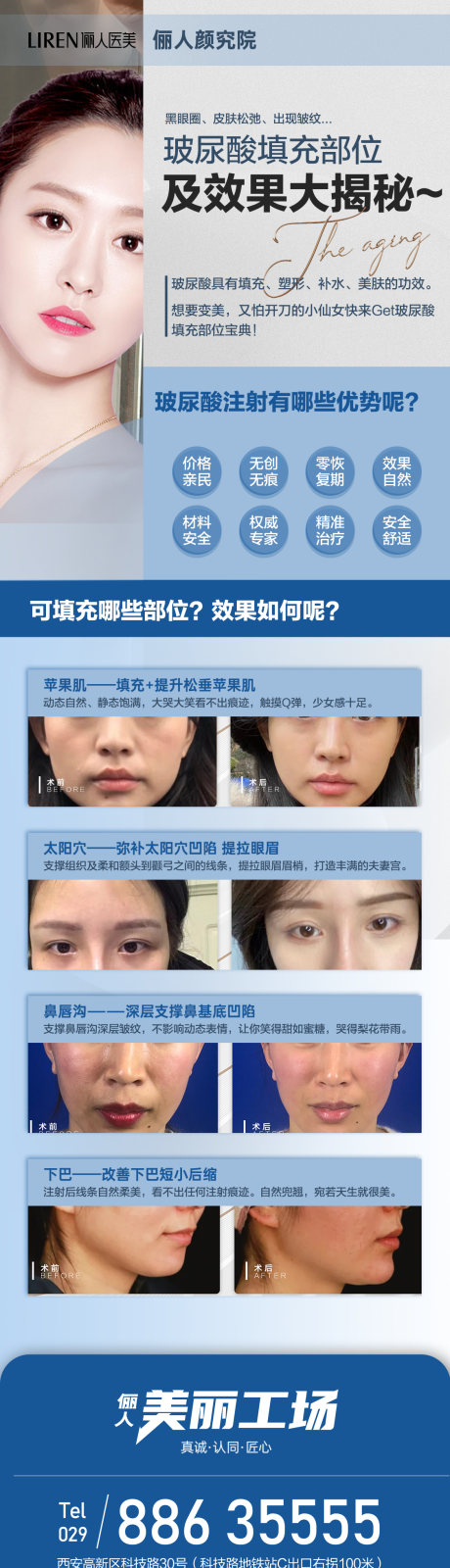 源文件下載【玻尿酸填充部位及效果大揭秘蘋果機淚溝】編號：10920011598636996