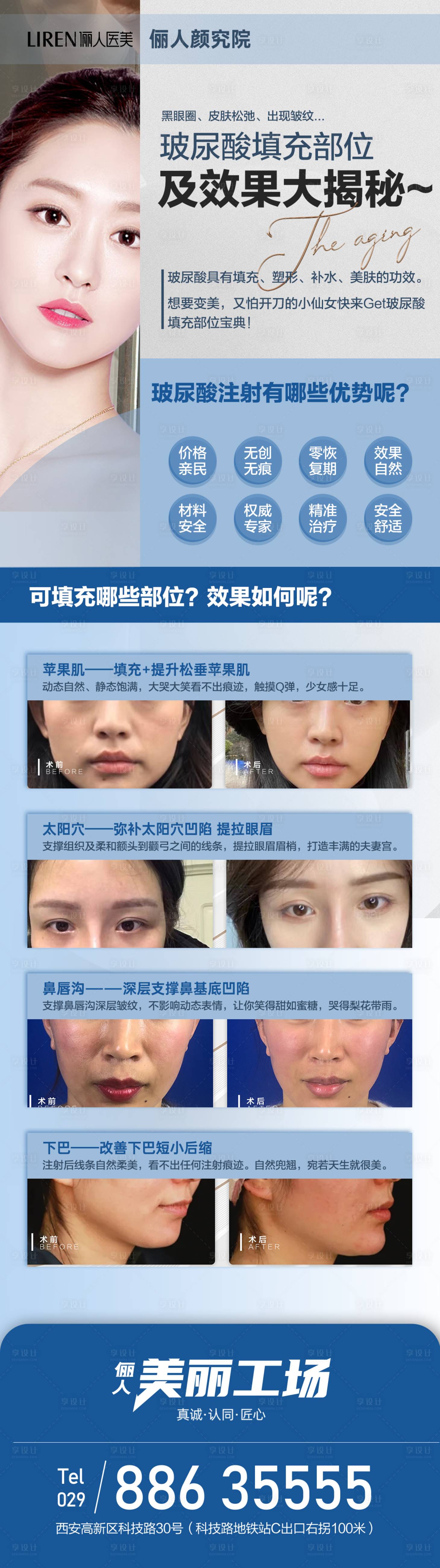 源文件下载【玻尿酸填充部位及效果大揭秘苹果机泪沟】编号：10920011598636996