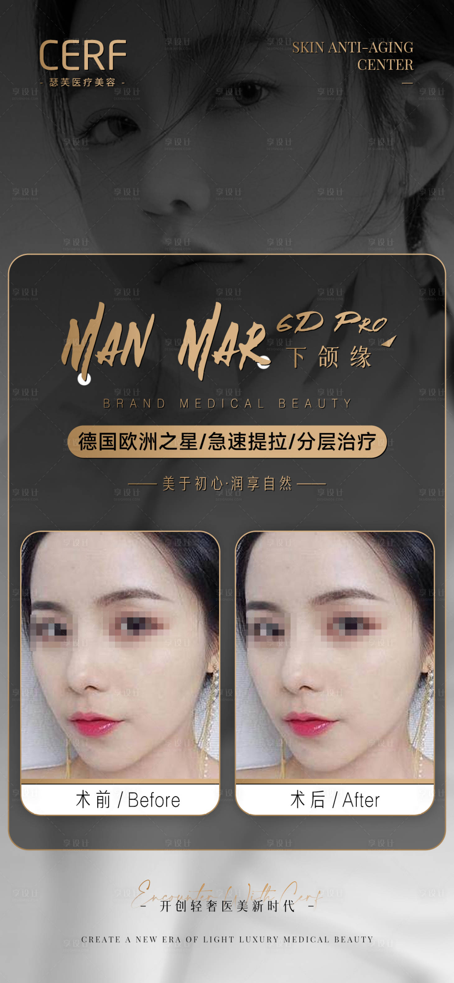 源文件下載【享設計】搜索編號：47470012349181104【醫美術后前后對比照海報】