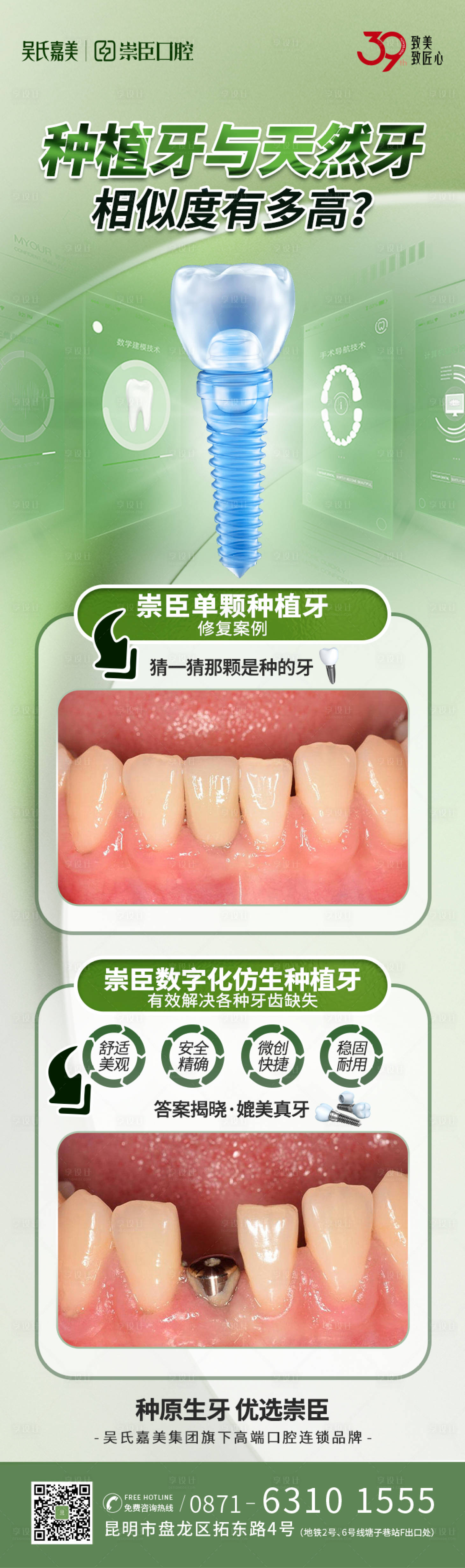 源文件下載【享設(shè)計(jì)】搜索編號(hào)：38450012379035946【種植牙與天然牙海報(bào)】
