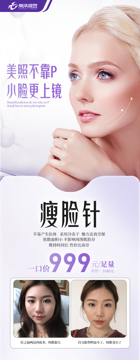 源文件下载【瘦脸针医美海报】编号：32510012031984468