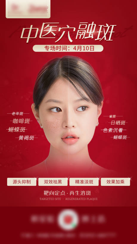 源文件下載【享設(shè)計】搜索編號：60470012151411520【醫(yī)美祛斑海報】