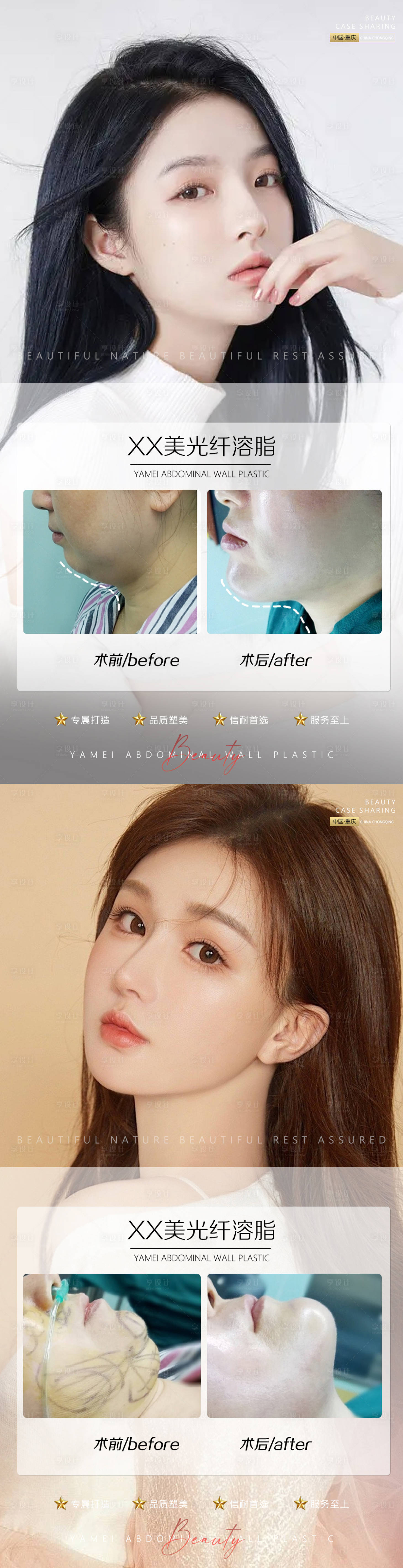 源文件下载【医美案例光纤溶脂海报】编号：25840012127008820