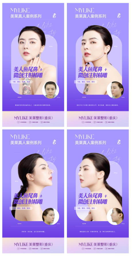 源文件下载【医美皮肤案例海报】编号：43000012218922983