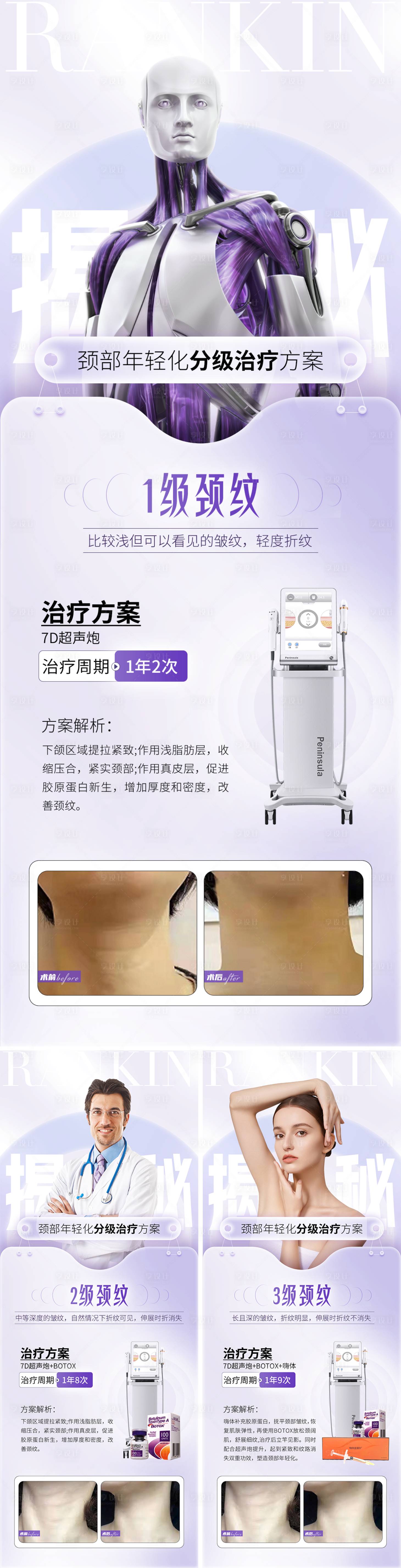 源文件下载【超声炮分级治疗】编号：73550012045815661