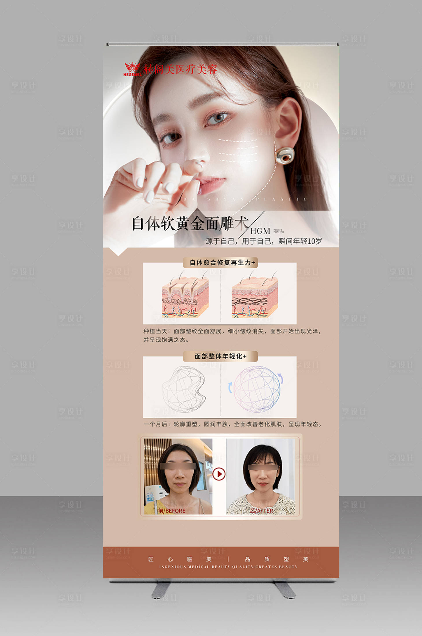 源文件下载【享设计】搜索编号：48200012501834571【医美项目展架】