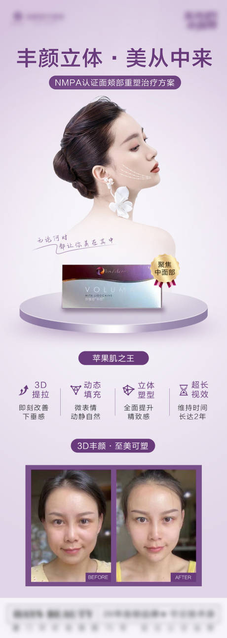 源文件下載【享設(shè)計(jì)】搜索編號(hào)：91640012141576680【醫(yī)美喬雅登玻尿酸豐顏 】