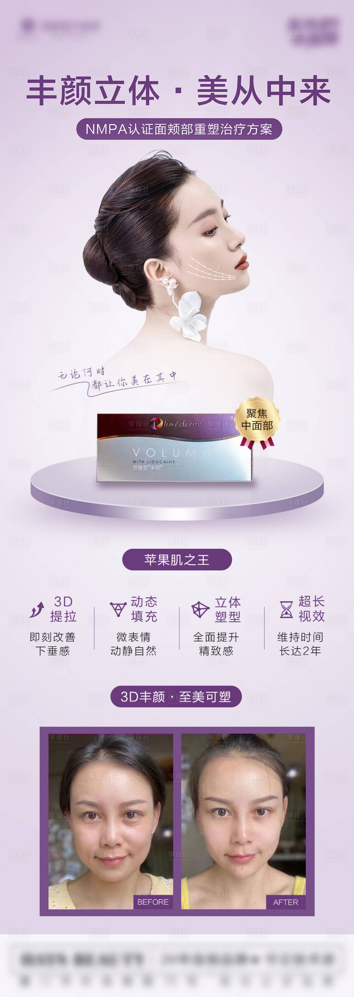 源文件下載【享設(shè)計】搜索編號：91640012141576680【醫(yī)美喬雅登玻尿酸豐顏 】