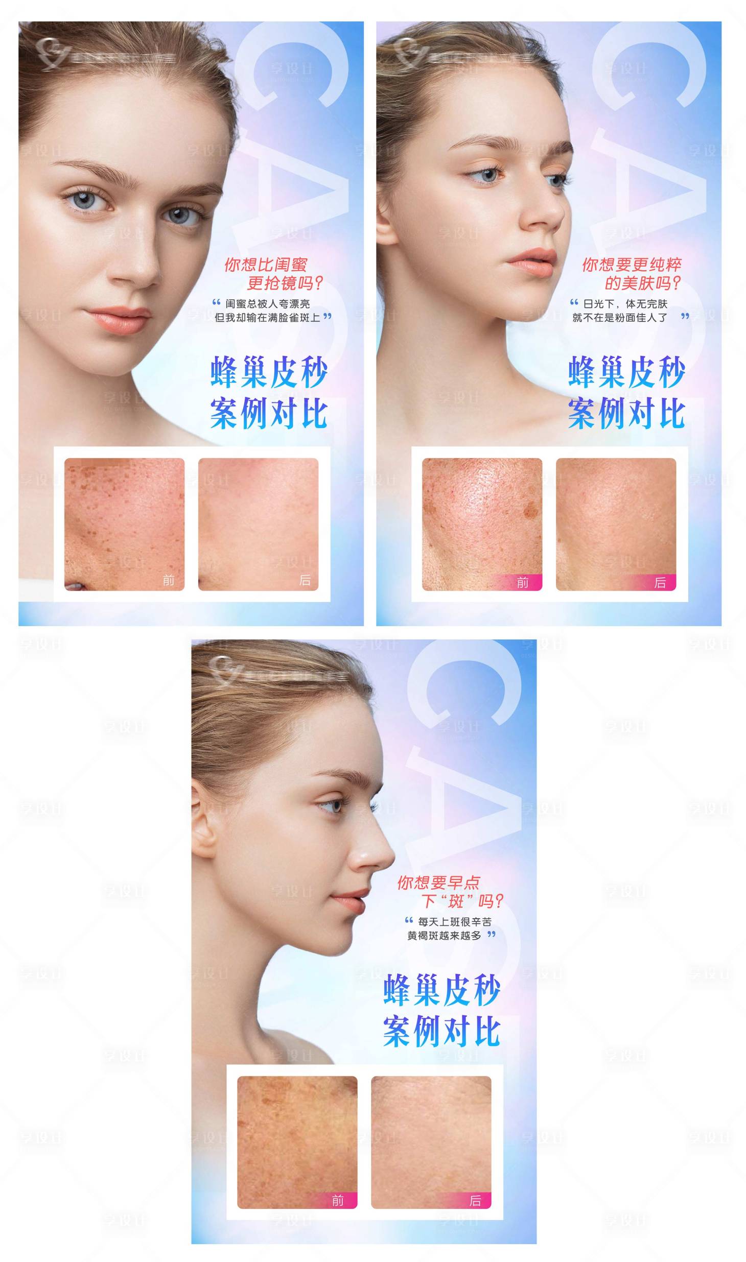 源文件下載【享設計】搜索編號：66140012411295940【醫美祛斑案例朋友圈圖】