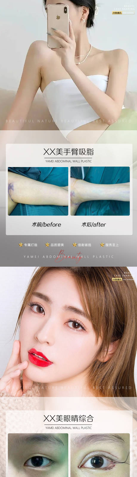 源文件下載【享設(shè)計(jì)】搜索編號(hào)：21180012063184262【醫(yī)美案例手臂吸脂系列海報(bào)】