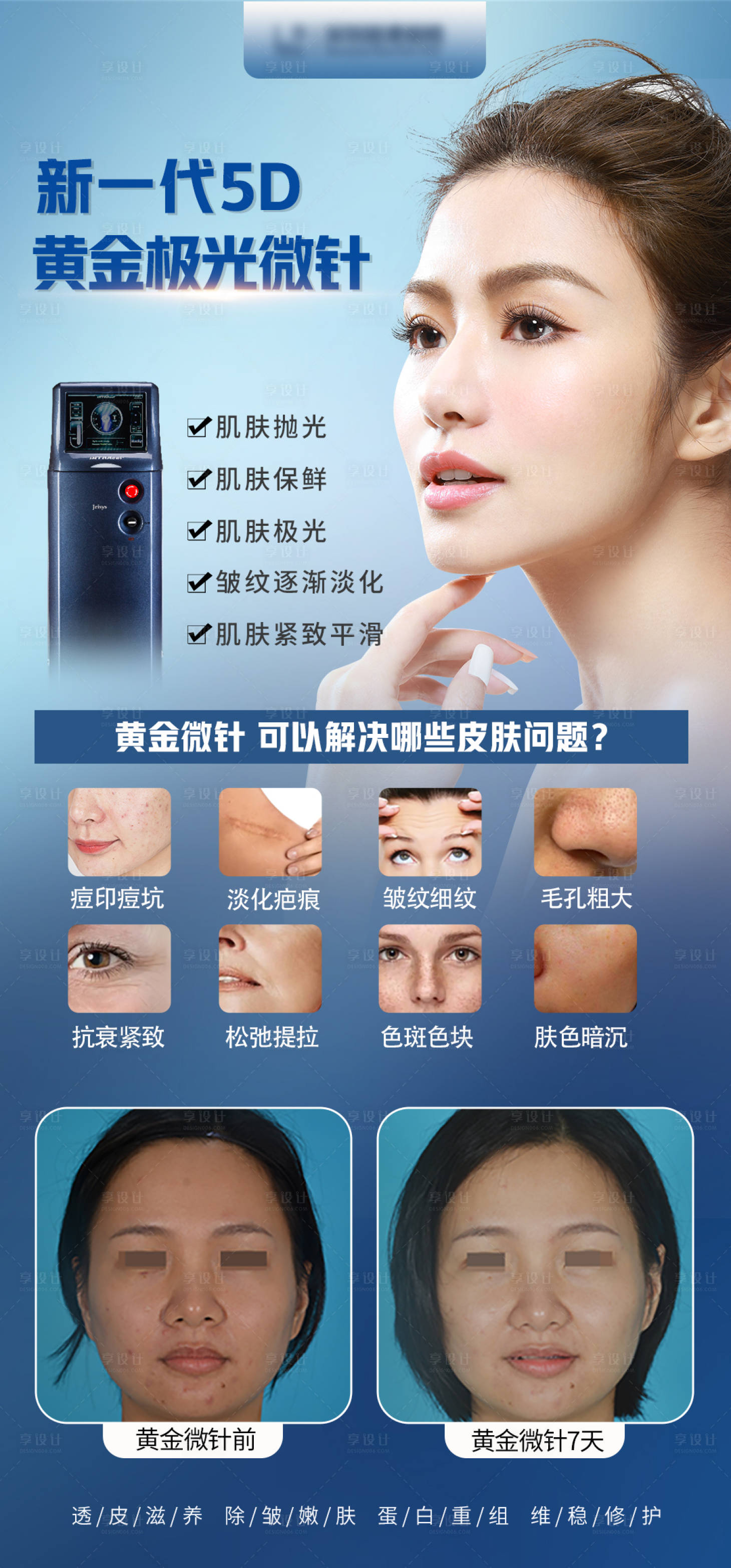 源文件下載【享設計】搜索編號：75180012325139337【整形醫美黃金微針項目宣傳海報】