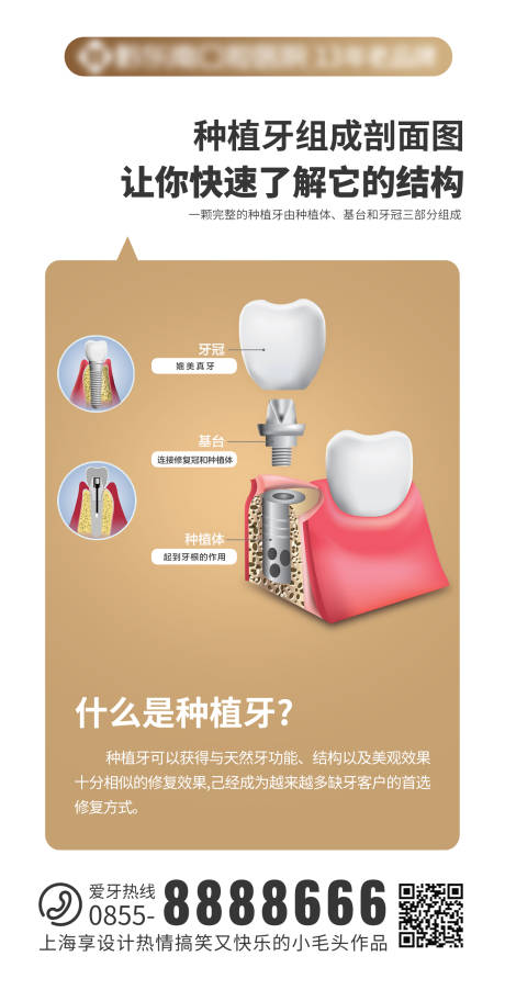 源文件下载【种植牙介绍海报】编号：20220912084716401