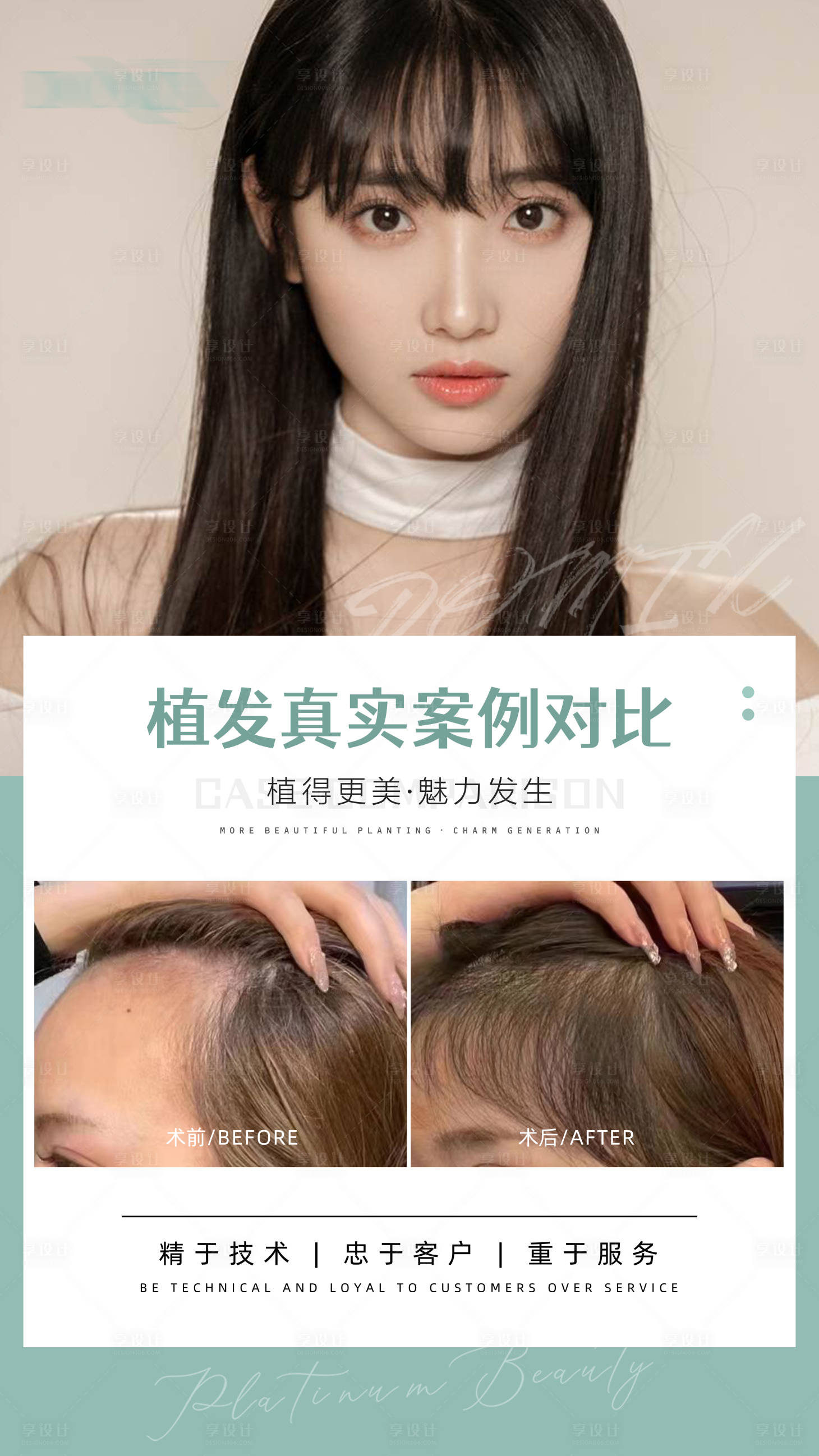 源文件下载【享设计】搜索编号：70650012092856523【植发案例医美对比海报】