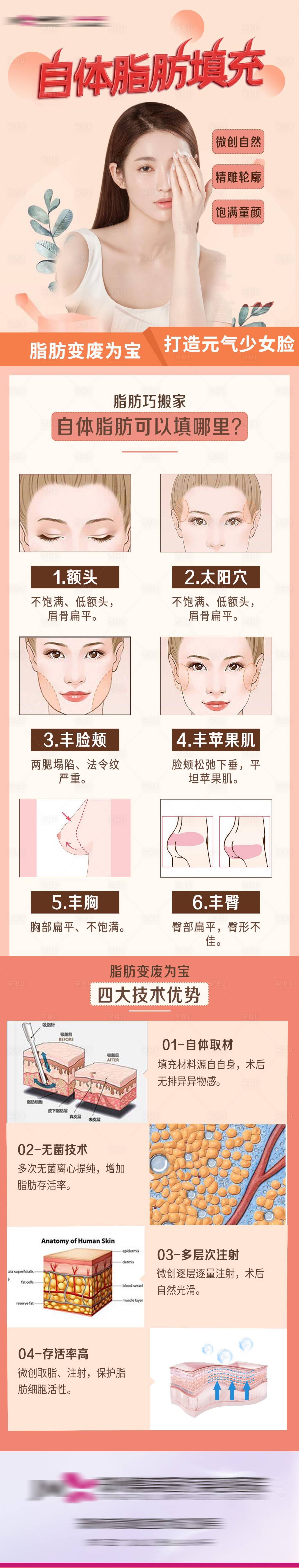 源文件下载【医美自体脂肪填充长图】编号：21530012244886325