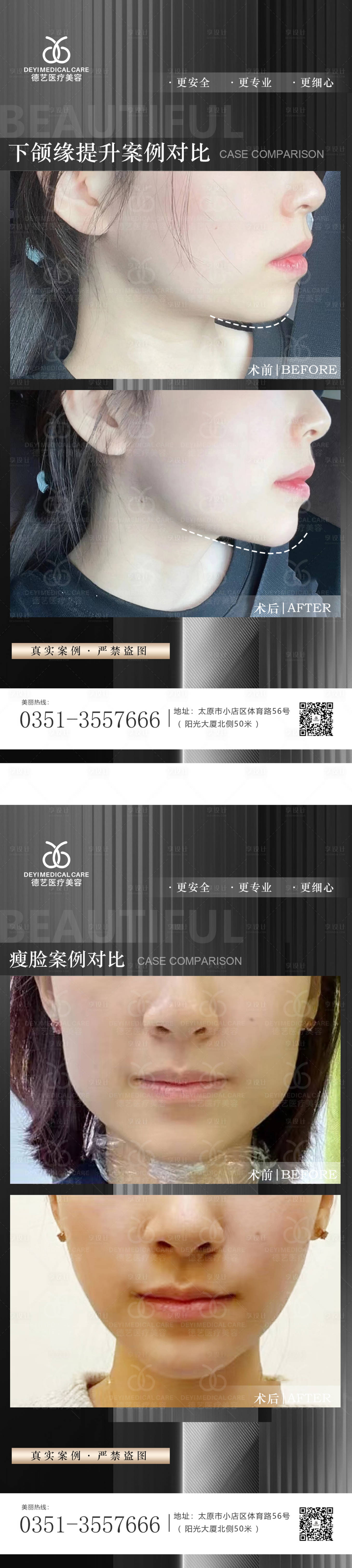 源文件下载【享设计】搜索编号：80030012136453354【医美案例对比图系列海报】