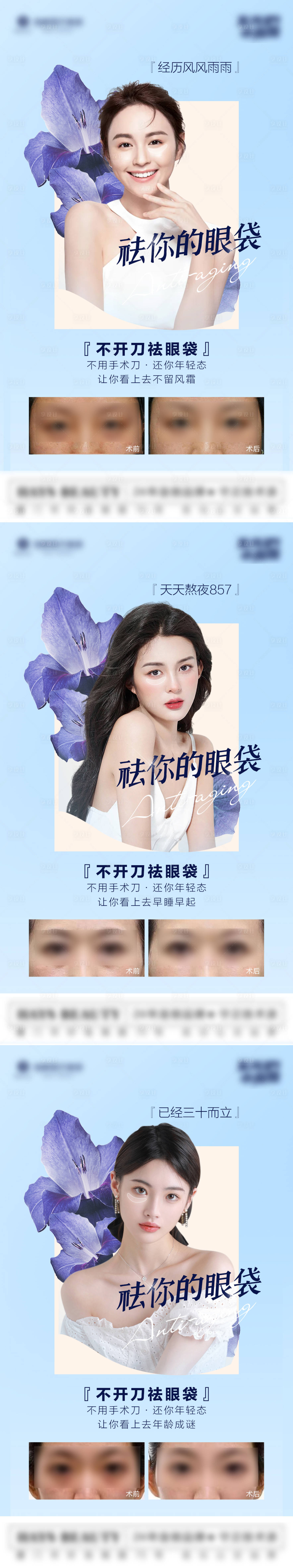 源文件下载【享设计】搜索编号：51560012141543162【不开刀祛眼袋】