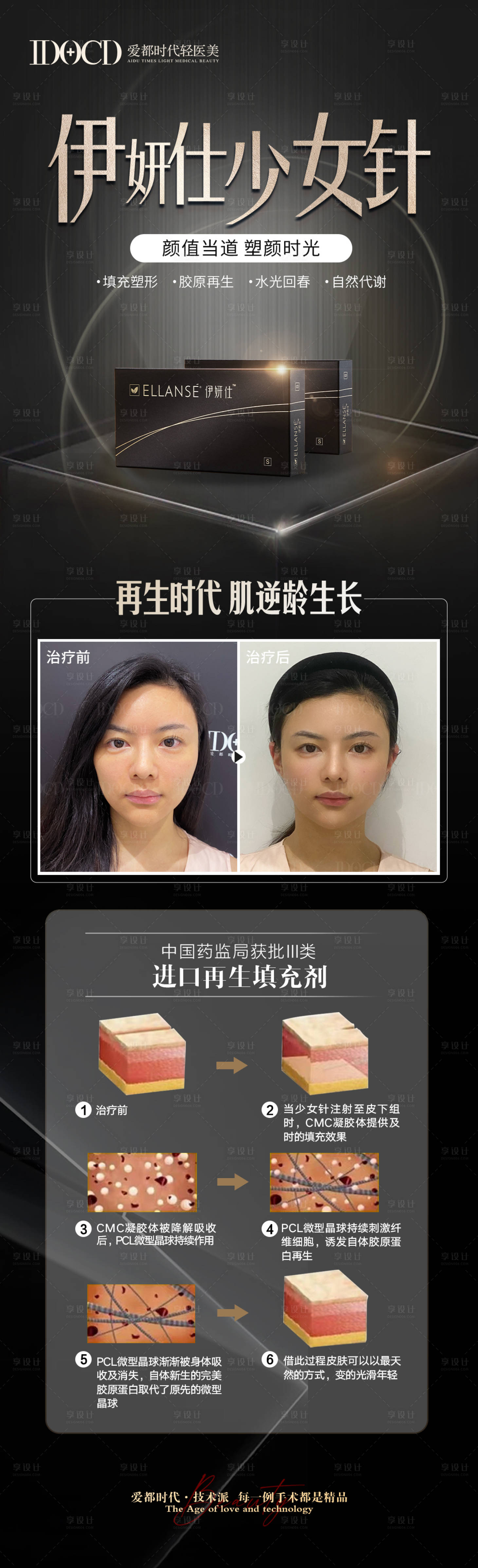 源文件下载【医美伊妍仕少女针案例长图海报】编号：65960011994328463