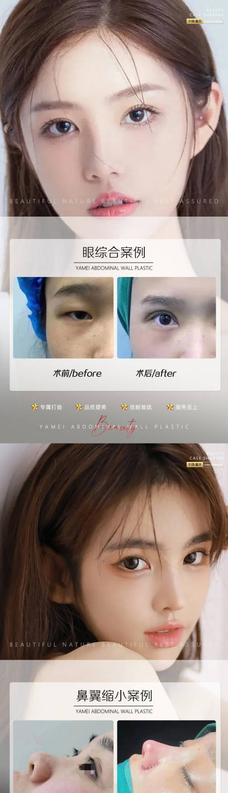 源文件下载【享设计】搜索编号：40770012015996666【医美案例鼻翼缩小 眼综合】