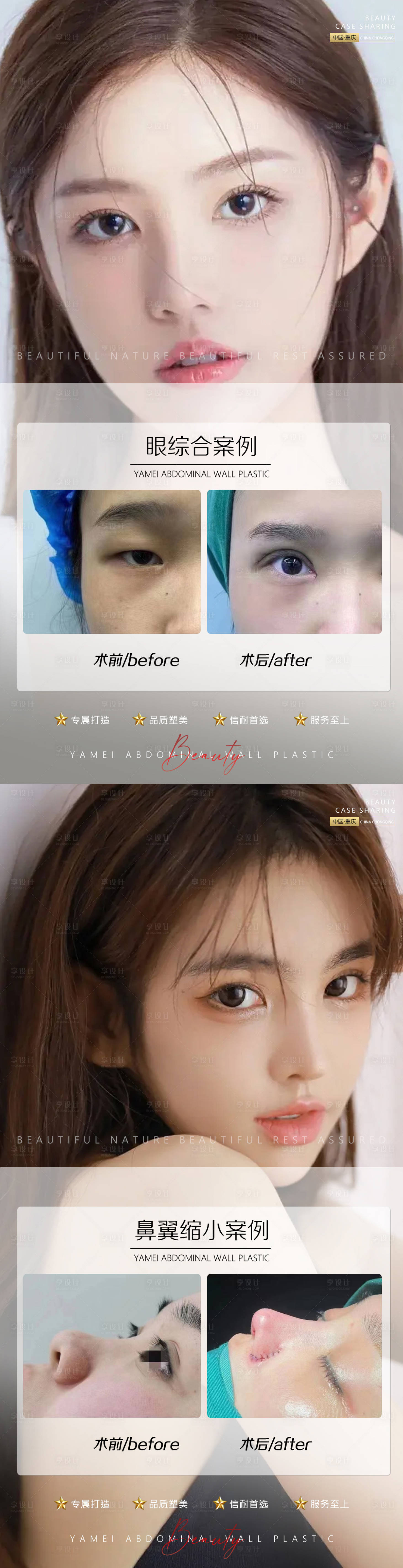 源文件下载【享设计】搜索编号：40770012015996666【医美案例鼻翼缩小 眼综合】