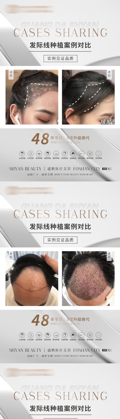 源文件下载【植发案例系列】编号：25700012207699442