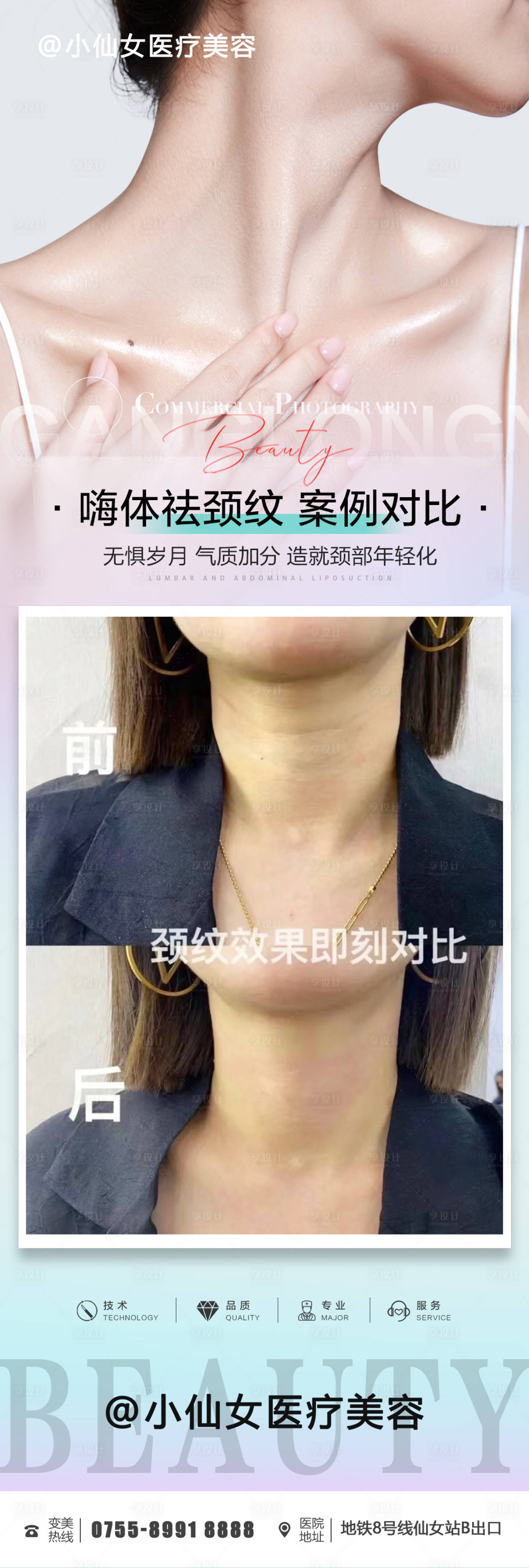 源文件下載【享設(shè)計(jì)】搜索編號：30490012191229908【醫(yī)美微整嗨體祛頸紋案例對比】