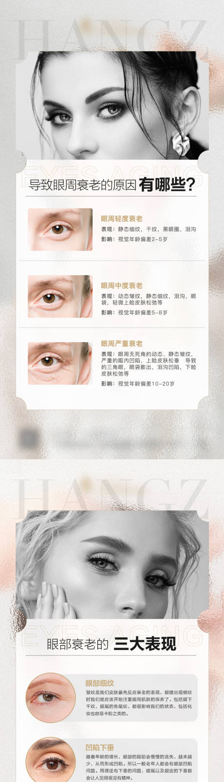 源文件下载【医美眼部衰老科普海报】编号：94300012203959699